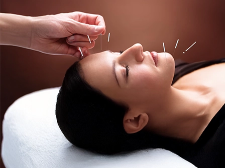 Get pain relief and wellness care from the best acupuncture therapy experts in Chennai.